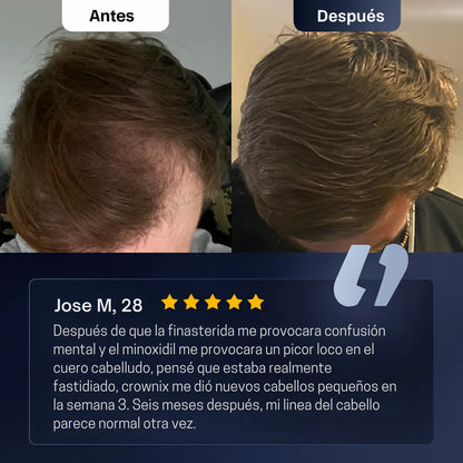 Roll on Crecimiento Capilar