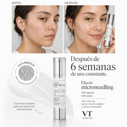 Suero Microneedling – Poros Más Pequeños, Piel de porcelana