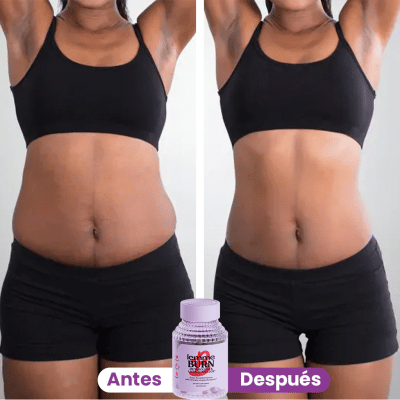 Lemme Burn - Suplemento Quemador | All Stars CR – Tienda🇨🇷